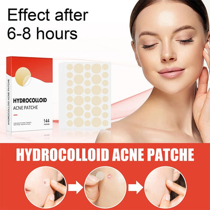 Professional Acne Patches, High-End Skin Care Pimple Stickers for Healing & Absorbing Spots
