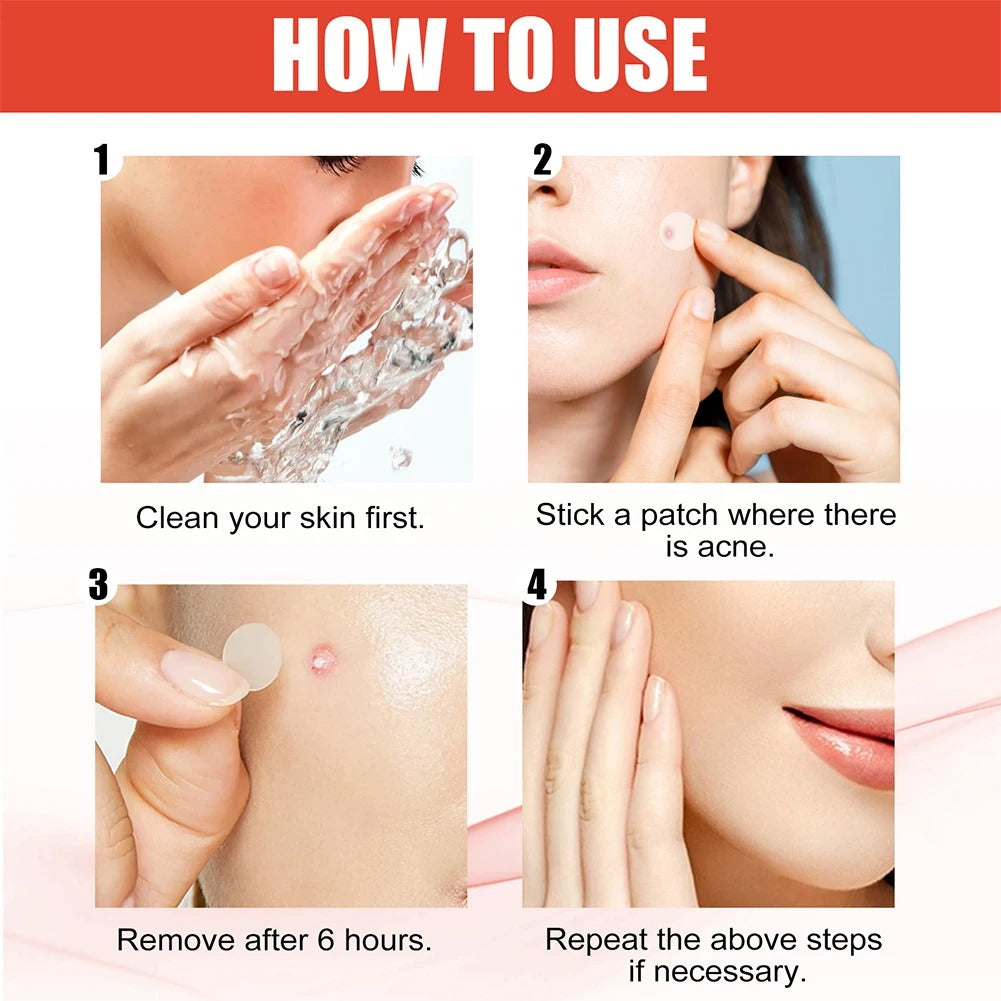 Professional Acne Patches, High-End Skin Care Pimple Stickers for Healing & Absorbing Spots