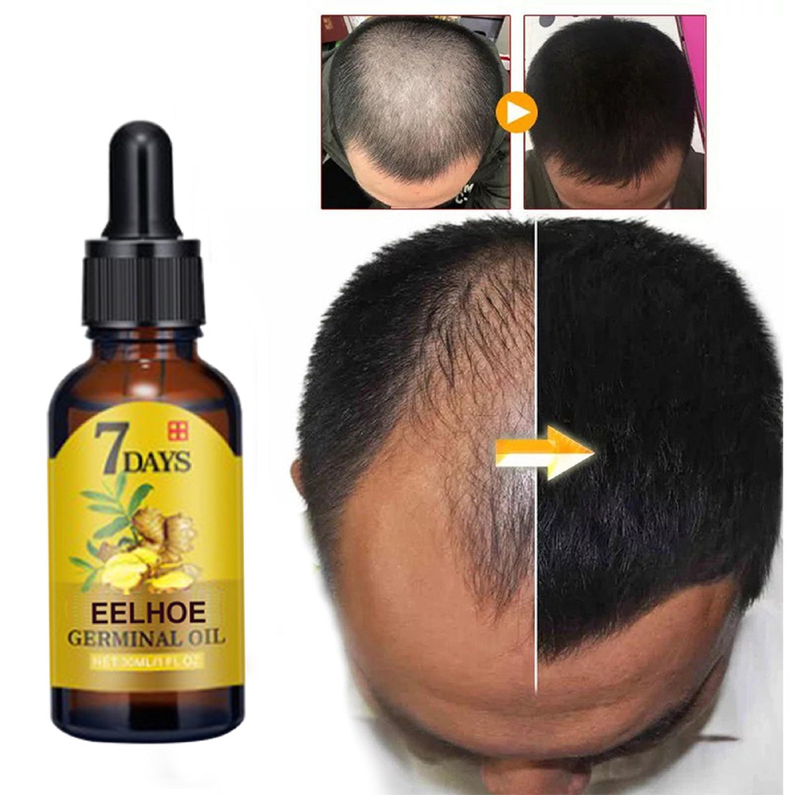 Ginger Hair Care Essence, Liquid Prevent Hair Loss, Nourish Hair Follicles & Strengthen Roots for Healthier Hair