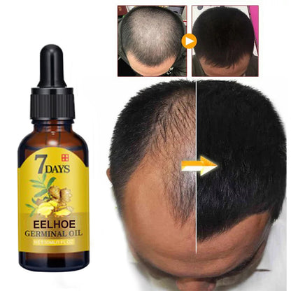 Ginger Hair Care Essence, Liquid Prevent Hair Loss, Nourish Hair Follicles & Strengthen Roots for Healthier Hair