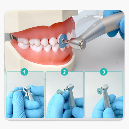 Dental Composite Polishing Discs, Gross Reduction & Contouring Mandrel Strips for Ceramics & Glass Ionomer Restorations