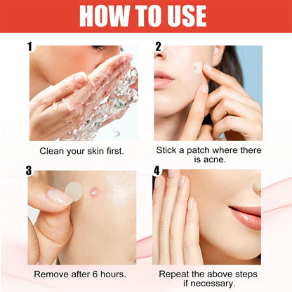 New HighEnd Acne Patches 240pcs Heart  Star Shape Hydrocolloid Dots for Moisturizing  Concealing