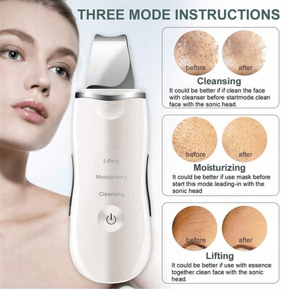 Deep Cleansing Facial Skin Scrubber  Face Spatula Exfoliator  Blackhead Pore Cleaner
