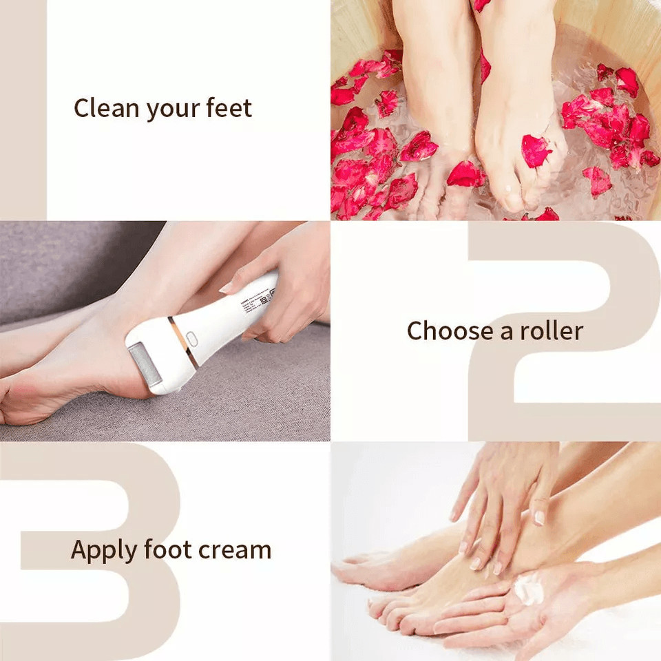 Professional Electric Foot Grinder File  ELMCHEE Callus  Dead Skin Remover Pedicure Tool With 3 Rol 3
