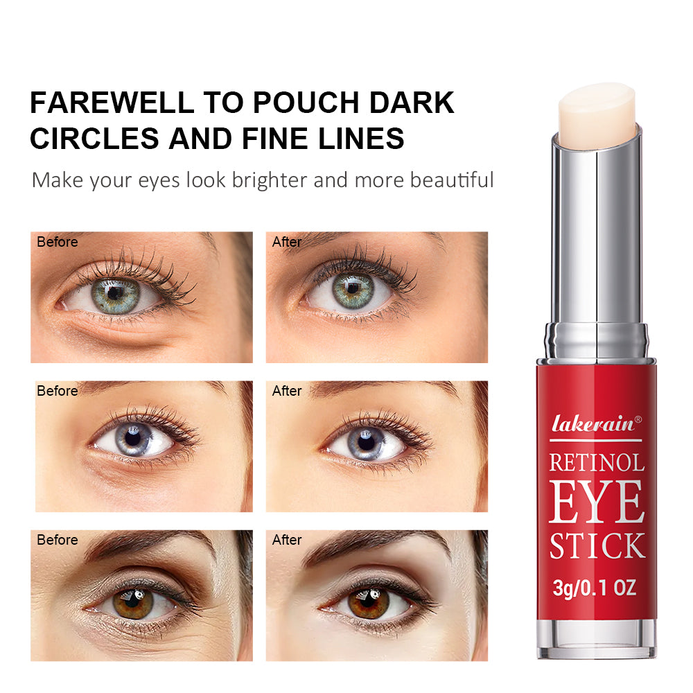 Retinol Eye Stick AntiAging Eye Cream For Dark Circles Puffiness  Fine Lines Brightening  Firming E 2