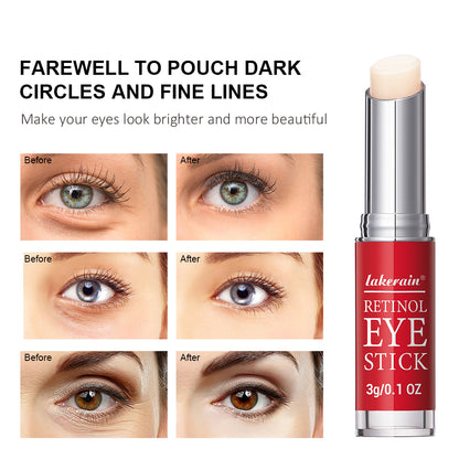 Retinol Eye Stick AntiAging Eye Cream For Dark Circles Puffiness  Fine Lines Brightening  Firming E 2