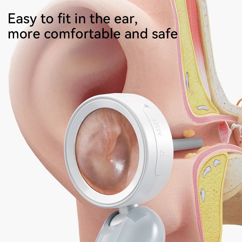 Visual Ear Camera 138 IPS Screen Wireless Endoscope 1080P HD Camera For Ear Wax Cleaning Picture Vi 2