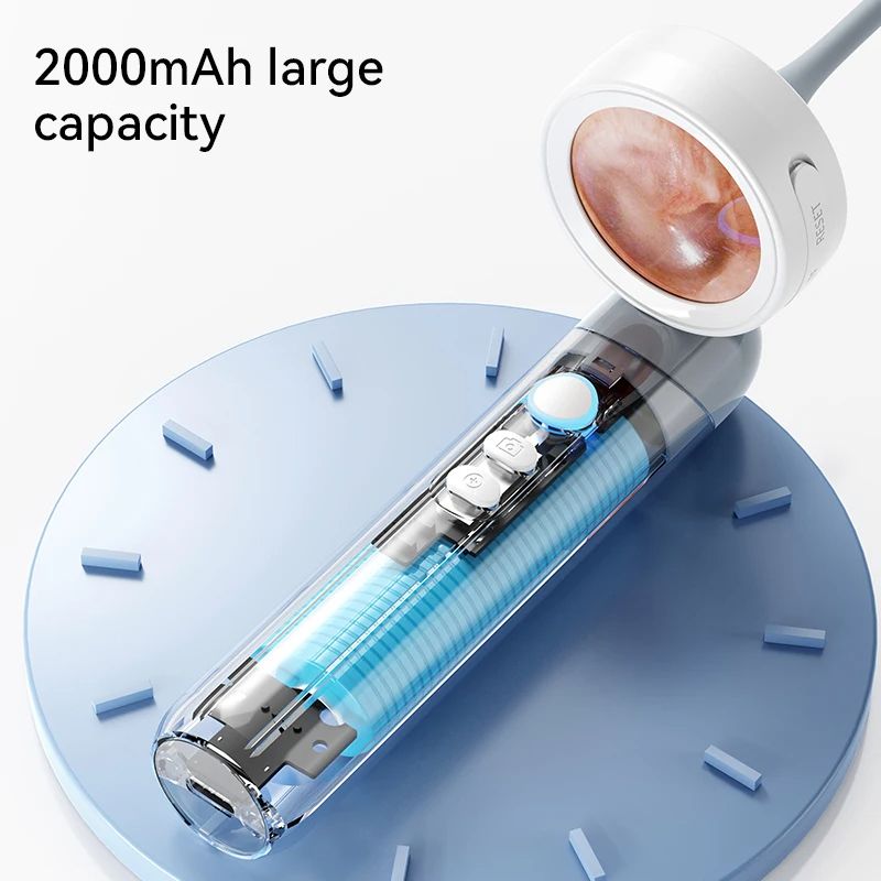 Visual Ear Camera 138 IPS Screen Wireless Endoscope 1080P HD Camera For Ear Wax Cleaning Picture Vi 5