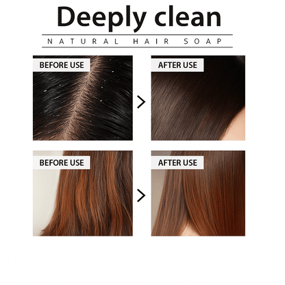 Lavender Oil Control Shampoo Silicone Free Refreshing Cleanse For Oily Scalp 1