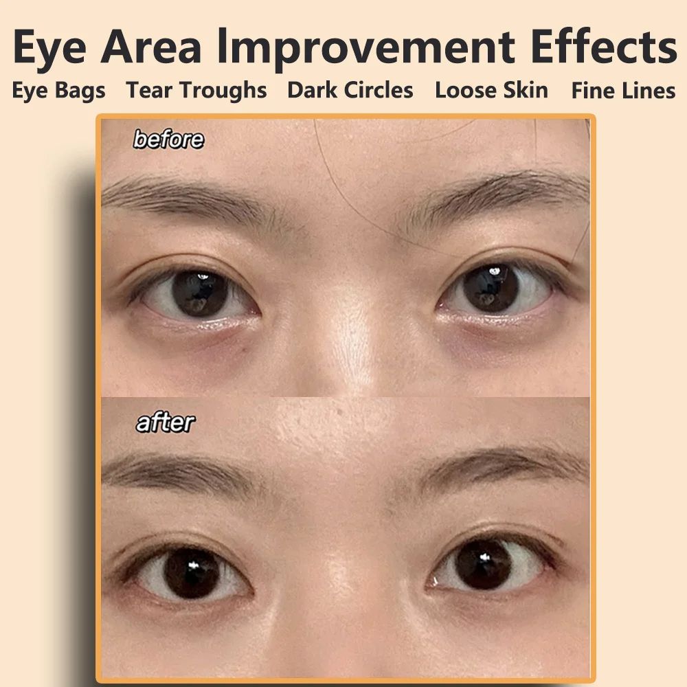 Eye  Face Beauty Massager  AntiWrinkle Skin Care Device For Facial Lifting Dark Circles  Fatigue Re 1