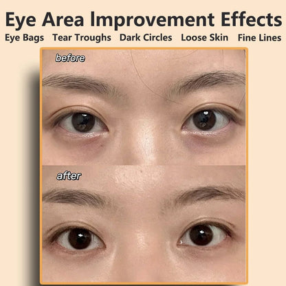 Eye  Face Beauty Massager  AntiWrinkle Skin Care Device For Facial Lifting Dark Circles  Fatigue Re 1