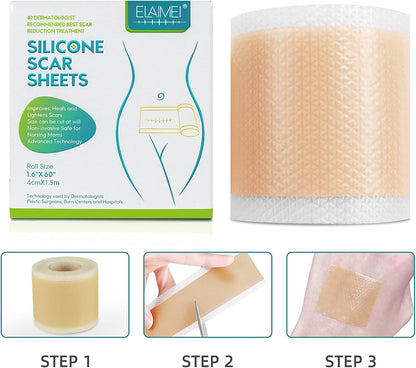 150cm SiliconTreatment E Scar Treatment Tape  Reusable Gel Patch For Acne Burn Surgical  Trauma Sca 1