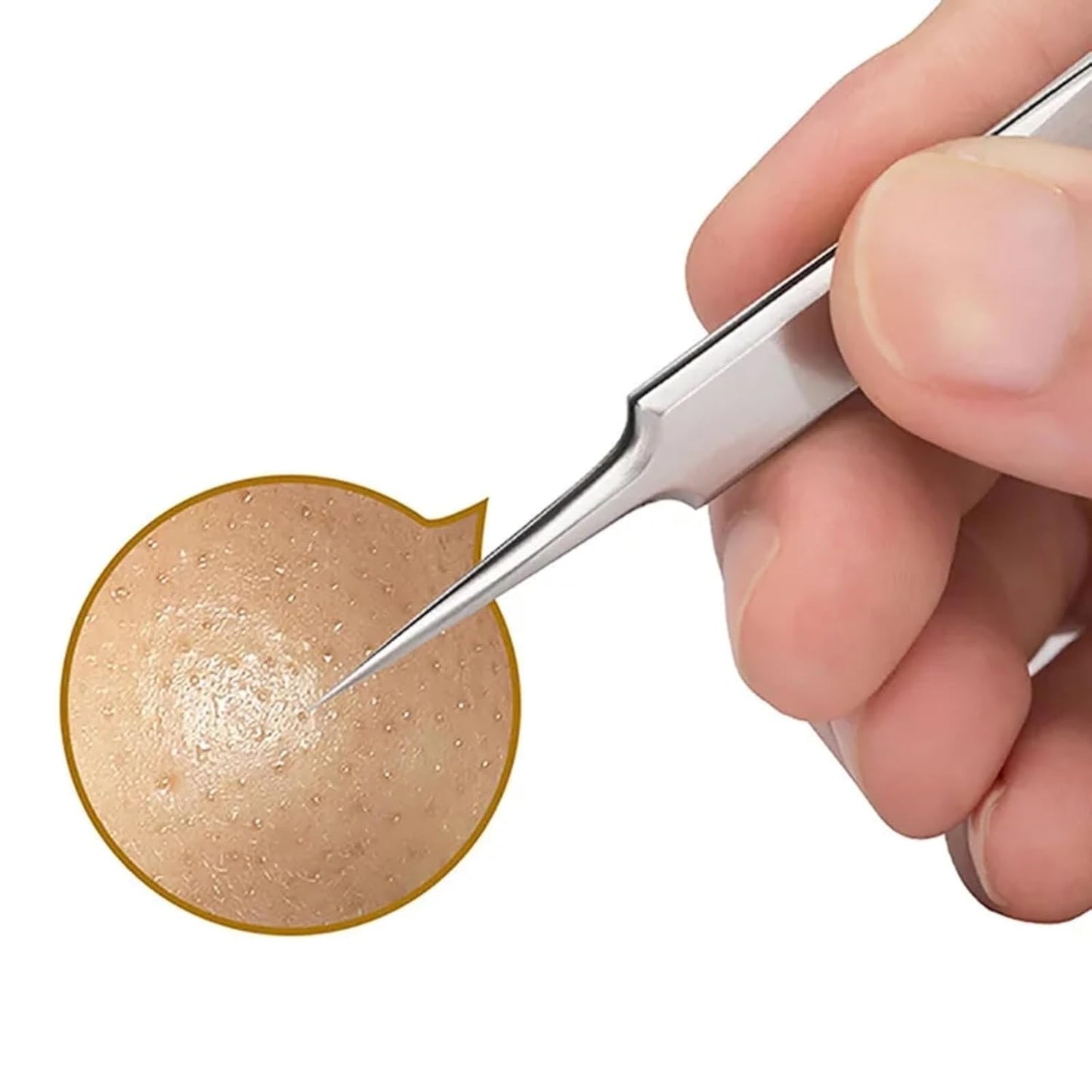 Ultra Fine Cellular Acne Blackhead Tweezers Precision Blackhead Tweezers For Clear Smooth Skin 3