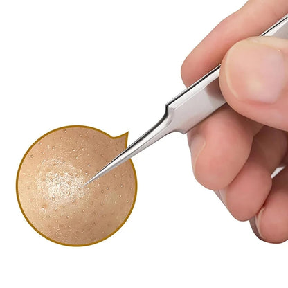 Ultra Fine Cellular Acne Blackhead Tweezers Precision Blackhead Tweezers For Clear Smooth Skin 3