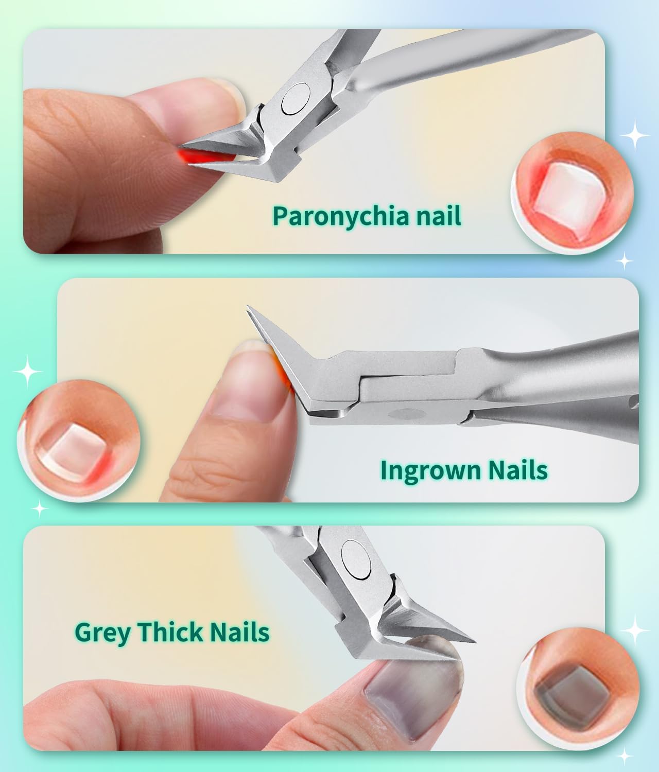 ProPed Nail Nipper Ingrown Toenail Clipper  Thick Toenail Nipper With Surgical Grade Stainless Stee 4
