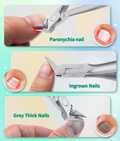 ProPed Nail Nipper Ingrown Toenail Clipper  Thick Toenail Nipper With Surgical Grade Stainless Stee 4