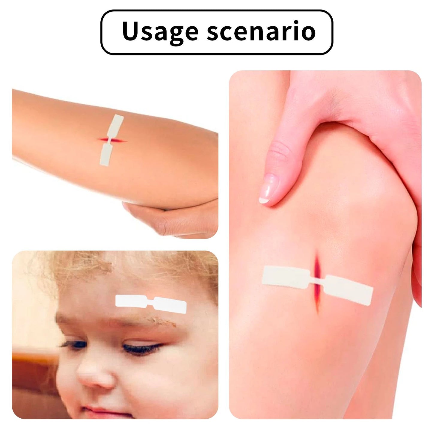 Small Waterproof Band Aid Butterfly Adhesive Wound Closure Bandage For Emergency Kit Sterile Adhesi 2