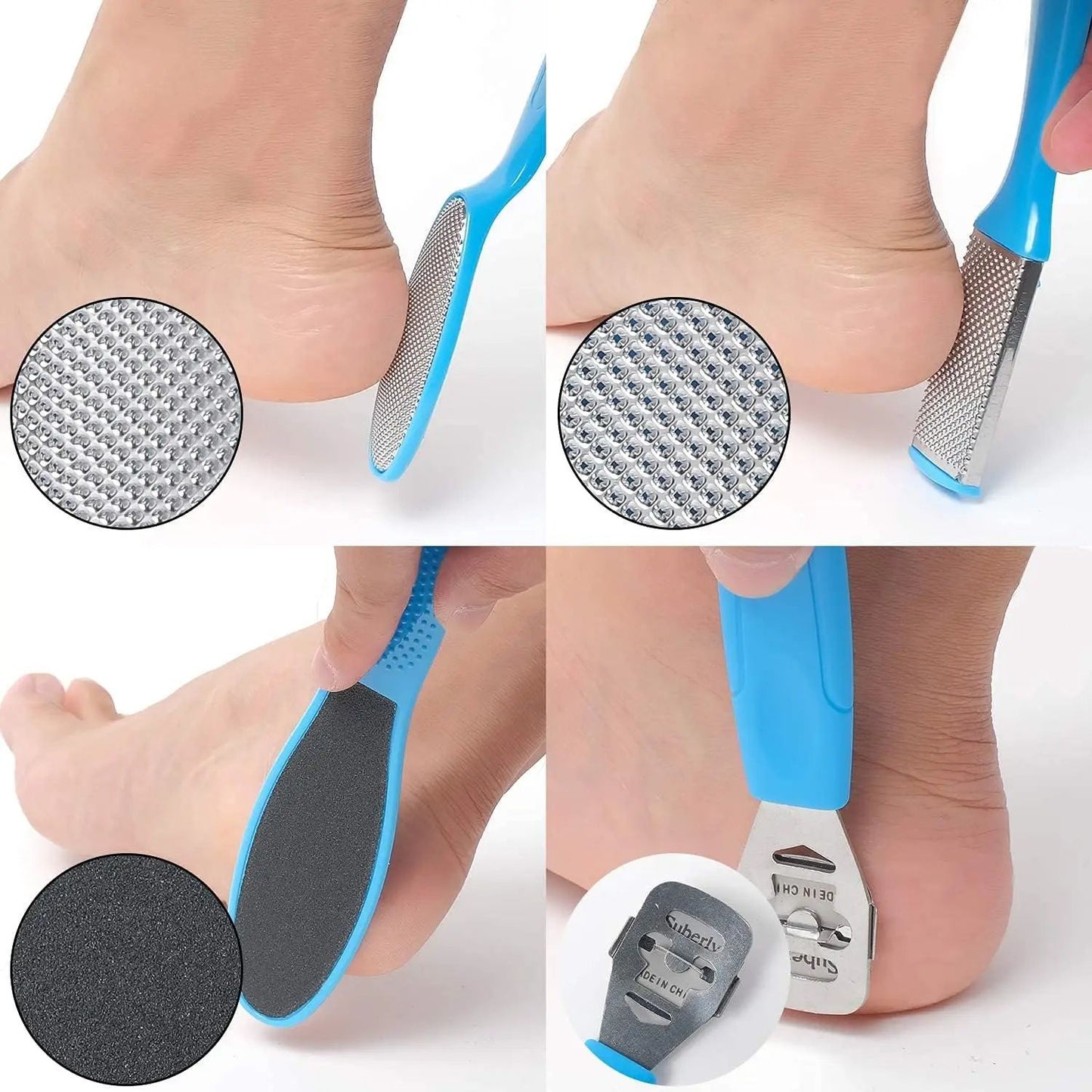 Deluxe Foot Octopus Fish Eye Exfoliating Heel Sharpener  Sole Crackles Removal Files Heel Cramping  2