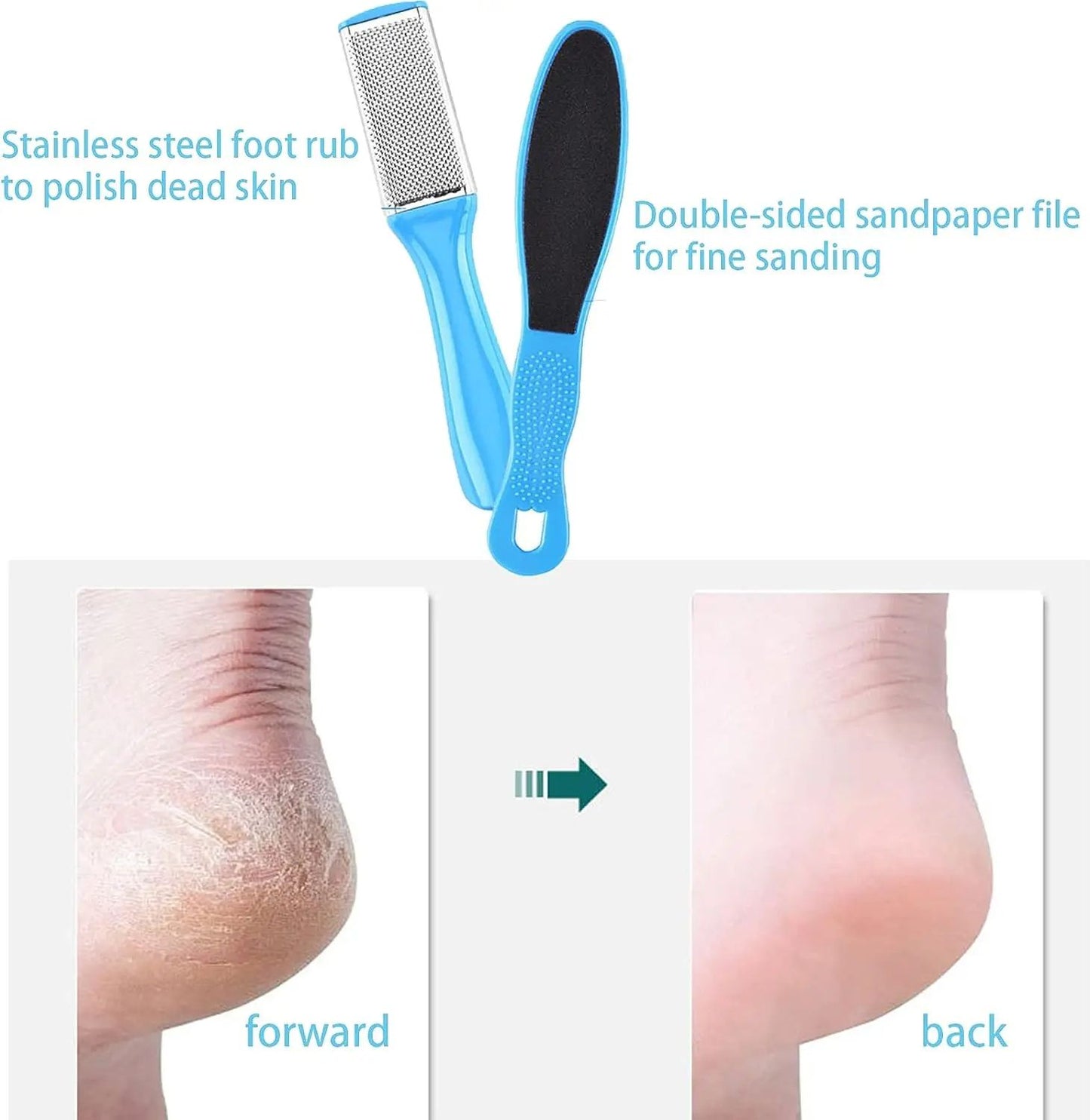 Deluxe Foot Octopus Fish Eye Exfoliating Heel Sharpener  Sole Crackles Removal Files Heel Cramping  3