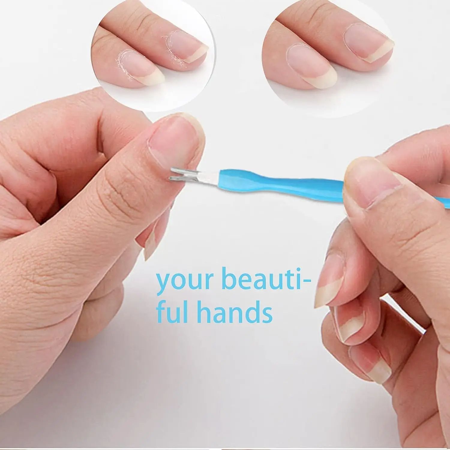 Deluxe Foot Octopus Fish Eye Exfoliating Heel Sharpener  Sole Crackles Removal Files Heel Cramping  4