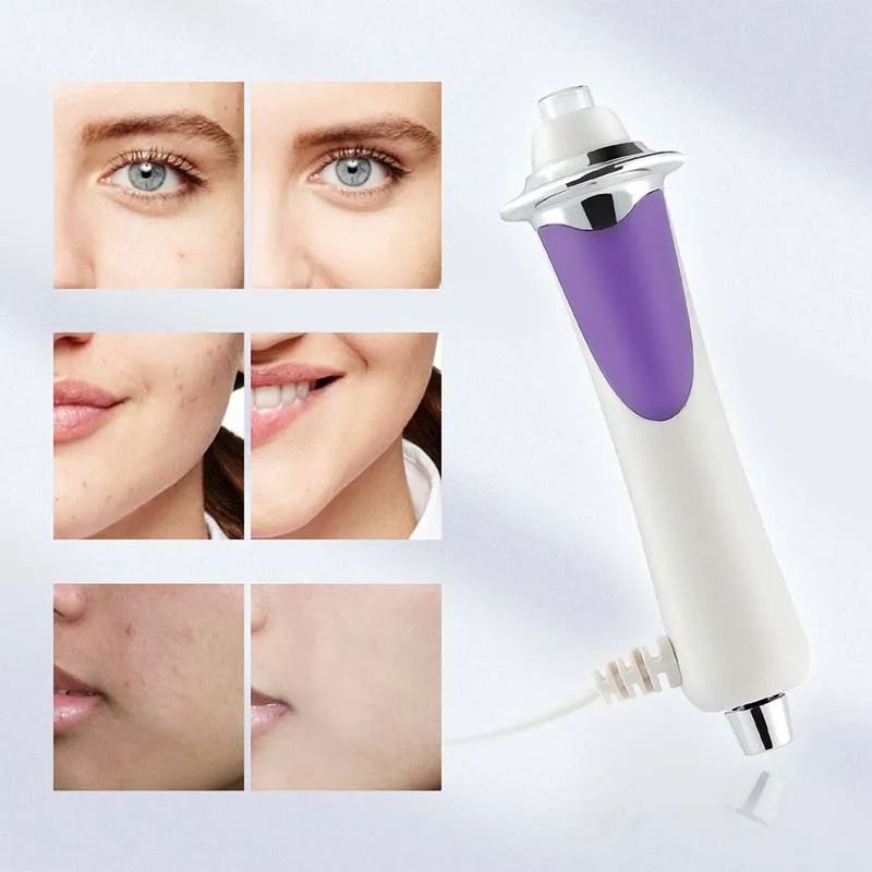 RF EMS Microcurrent Skin Tightening Anti Wrinkle Face Lifting Device Radio Frequency Beauty Oxygen  5