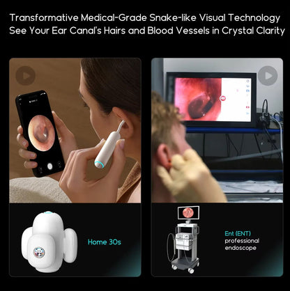Visual Ear Wax Remover Family Ear Care Assistant Kit For Children Elderly  Lover Camera  UV Sterili 1