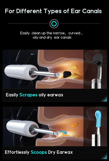 Visual Ear Wax Remover Family Ear Care Assistant Kit For Children Elderly  Lover Camera  UV Sterili 4