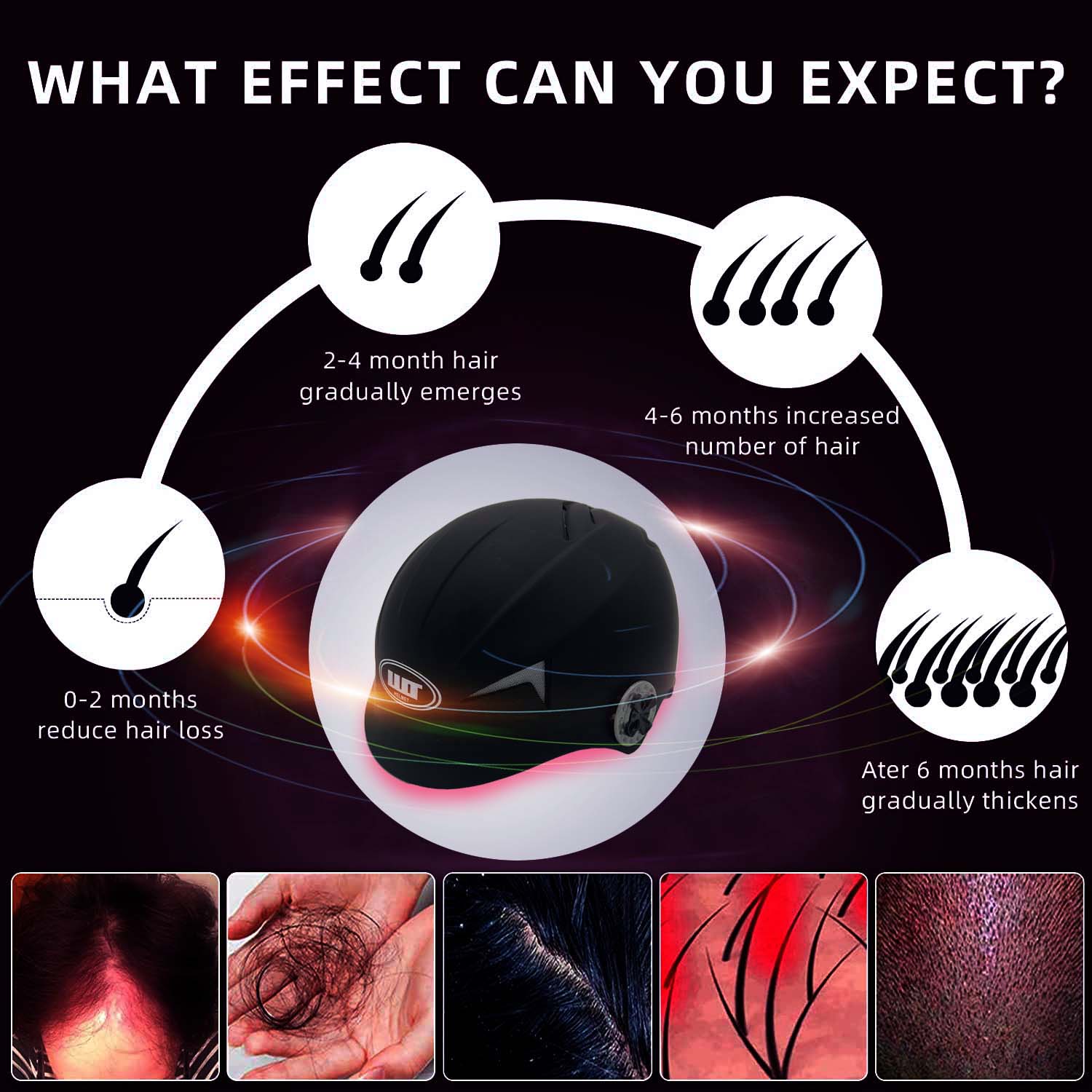 LLLT Hair Growth Helmet, 650nm Low-Level Laser Therapy Cap for Hair Loss Treatment & Regrowth