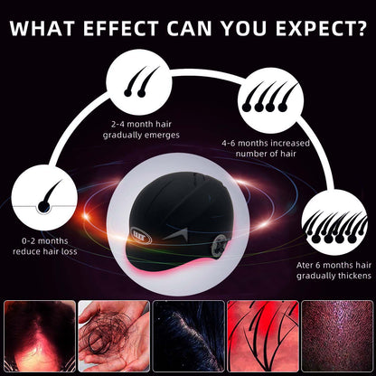LLLT Hair Growth Helmet, 650nm Low-Level Laser Therapy Cap for Hair Loss Treatment & Regrowth