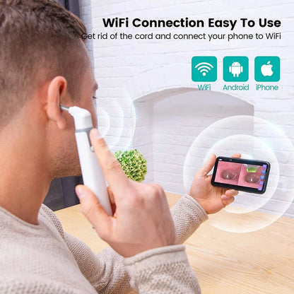 Wireless Otoscope Ear Camera With Dual View UltraThin 720P HD WiFi Ear Scope For Kids Adult 6 LED L 5