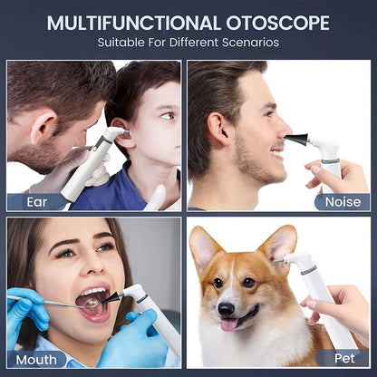 HD Wireless Otoscope Ear Camera With Dual View WiFi Ear Scope With LED Lights For Safe Ear Cleaning 3