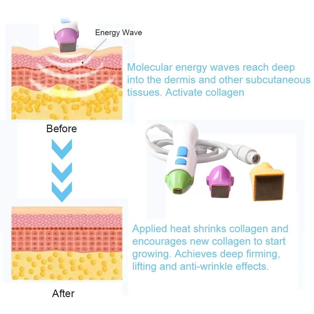 Replacement Skin Care Tips for Face, Eye & Body Rejuvenation Machine Cartridges