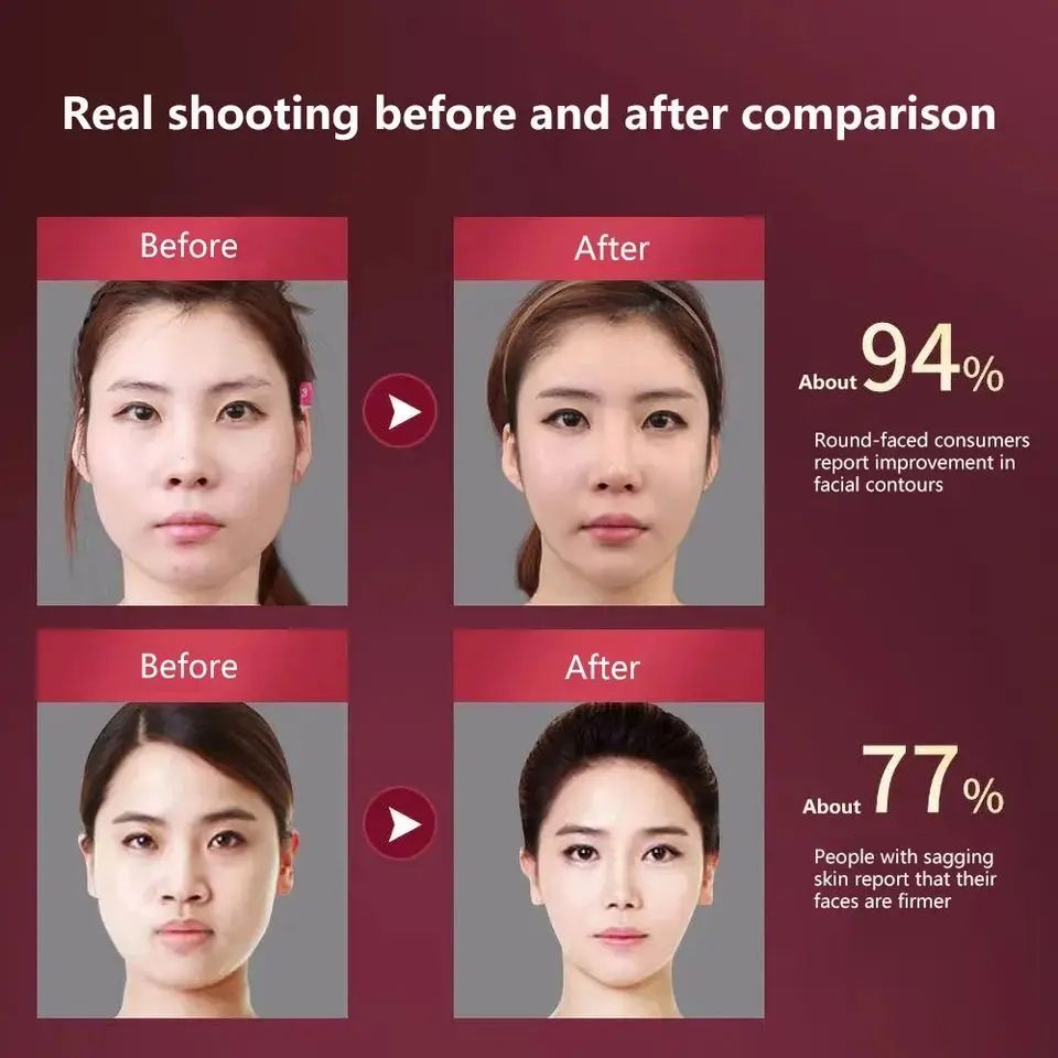 Facial Slimming Vibration Massager With LED Photon Therapy Heated V Face Lifting Device For Double  5