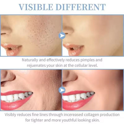 4in1 High Frequency Facial Wand For Acne Treatment And Skin Rejuvenation 5
