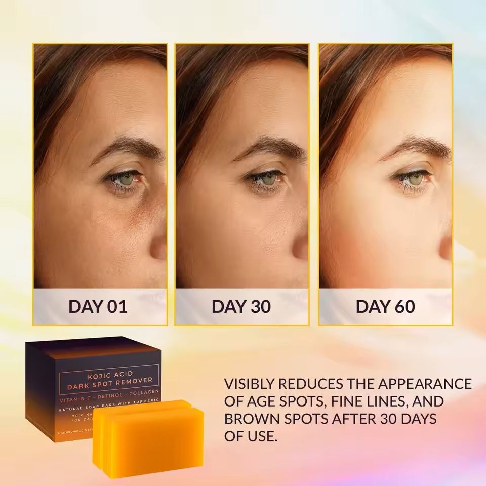 Kojic Acid Brightening Soap Bar 5