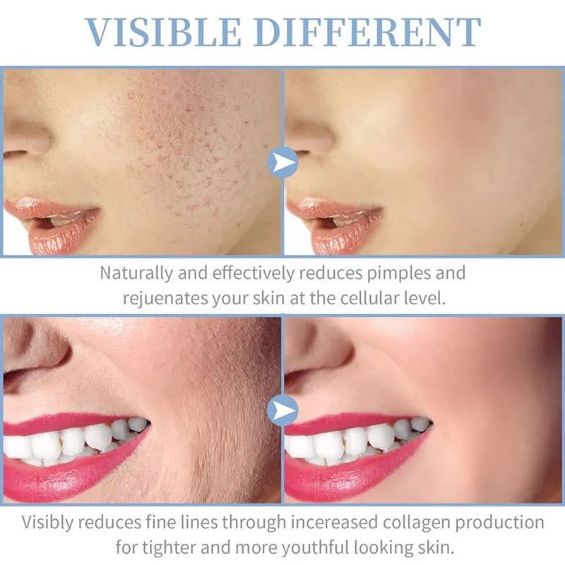 4-in-1 Handheld Electric Face Skin Beauty Tool Portable High Frequency Facial Therapy Wand for Acne Treatment & Skin T
