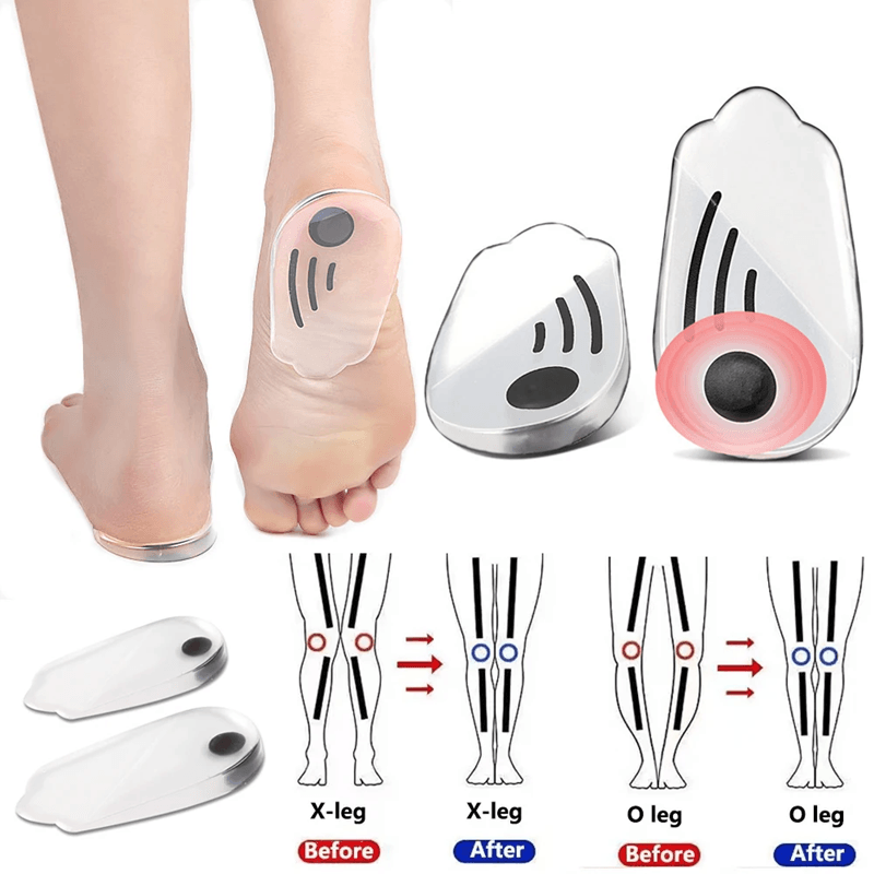 Magnetic Silicone Orthopedic Insoles  Plantar Fasciitis Relief  Foot Correction Heel Pads For OX Le 1