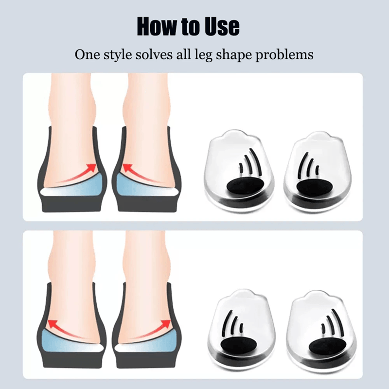 Magnetic Silicone Orthopedic Insoles  Plantar Fasciitis Relief  Foot Correction Heel Pads For OX Le 6