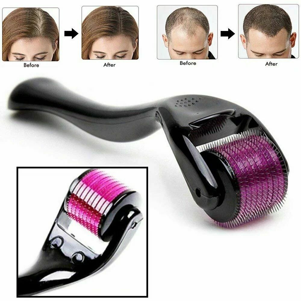 540 Titanium Microneedle Derma Roller For Hair  Beard Regrowth AntiHair Loss Skin Rejuvenation  Col 9