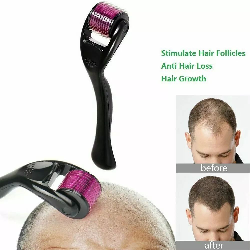 540 Titanium Microneedle Derma Roller For Hair  Beard Regrowth AntiHair Loss Skin Rejuvenation  Col 10