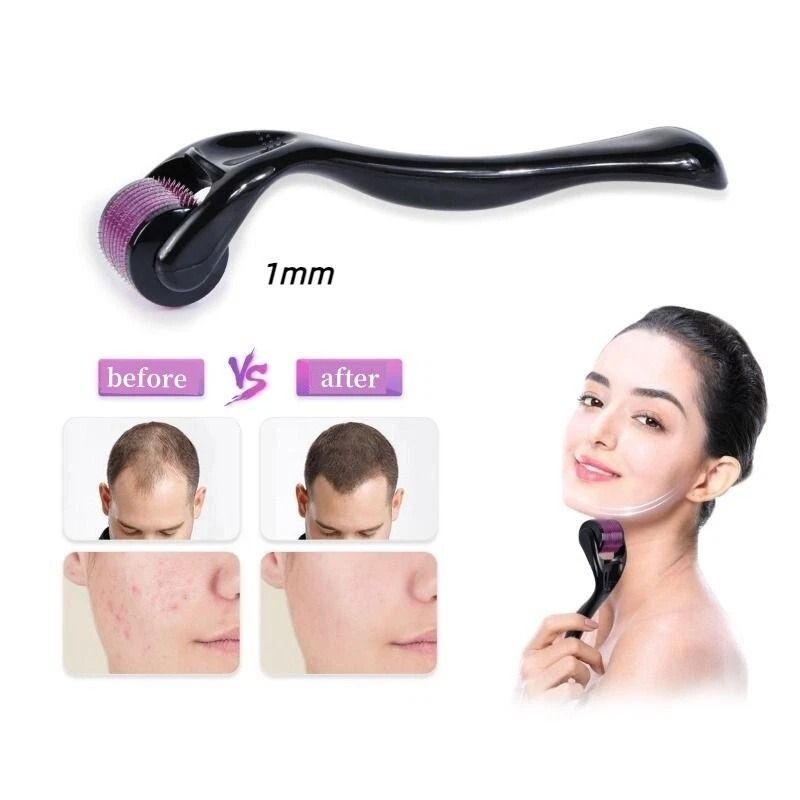 540 Titanium Microneedle Derma Roller For Hair  Beard Regrowth AntiHair Loss Skin Rejuvenation  Col 8