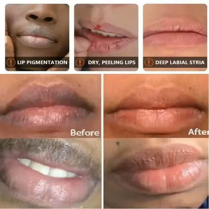 Lip Lightening Balm Mask  Melanin Care  Moisture Repair 2