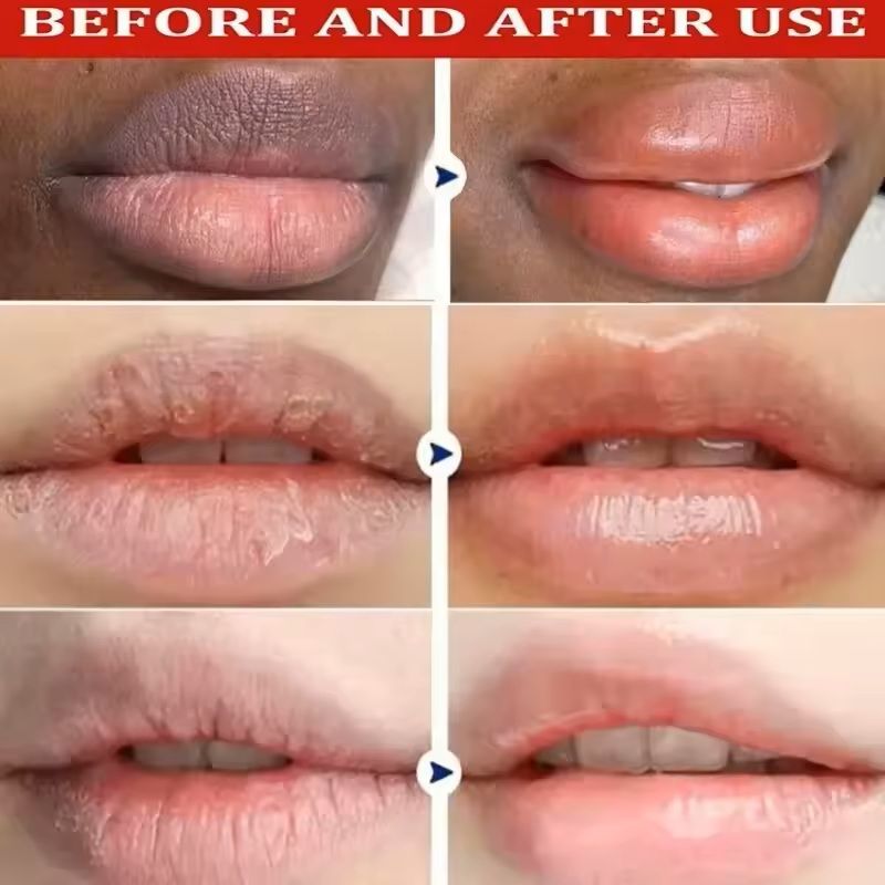 Lip Lightening Balm Mask  Melanin Care  Moisture Repair 6