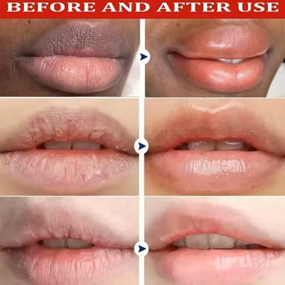 Lip Lightening Balm Mask  Melanin Care  Moisture Repair 6