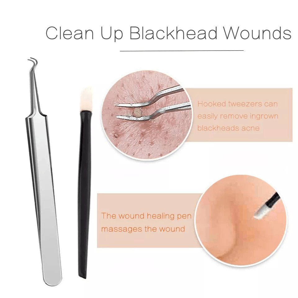 Blackhead Remover Kit Stainless Steel Pimple Popper Tools Comedone Extractor Set For Acne Zit White 3