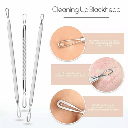 Blackhead Remover Kit Stainless Steel Pimple Popper Tools Comedone Extractor Set For Acne Zit White 4