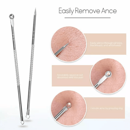Blackhead Remover Kit Stainless Steel Pimple Popper Tools Comedone Extractor Set For Acne Zit White 5