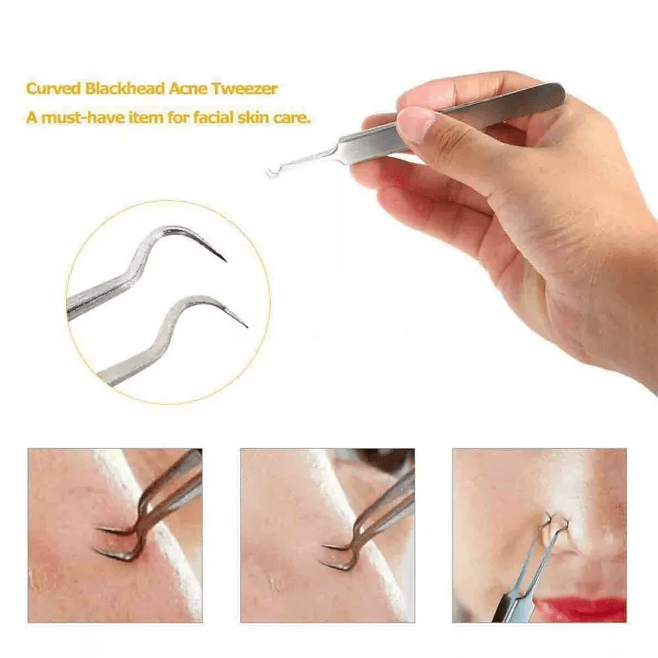 Blackhead Remover Kit Stainless Steel Pimple Popper Tools Comedone Extractor Set For Acne Zit White 1