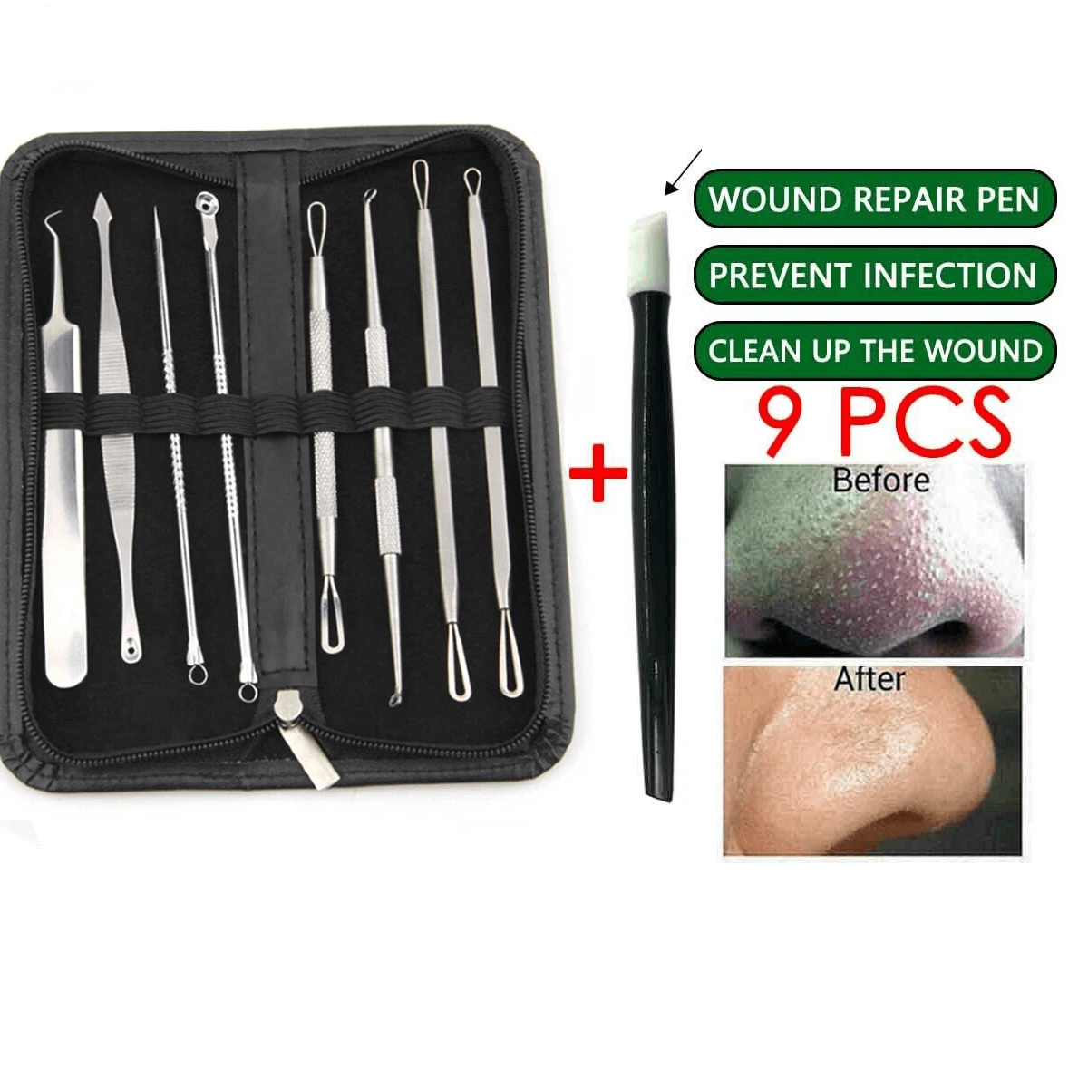 Blackhead Remover Kit, Stainless Steel Pimple Popper Tools, Comedone Extractor Set for Acne, Zit, Whitehead & Skin Care