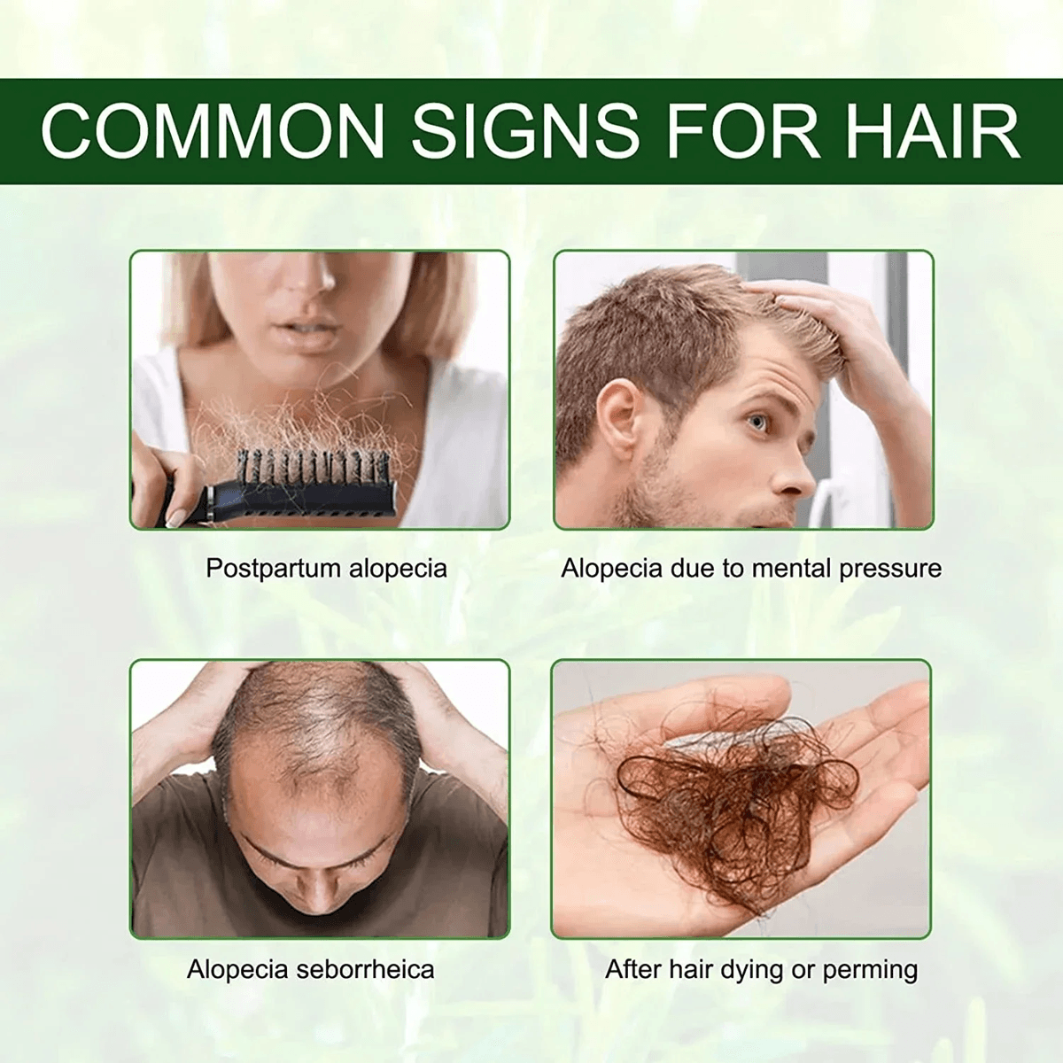 FastActing Hair Growth Oil  Natural Anti Hair Loss Serum For Baldness And Postpartum Regrowth 1